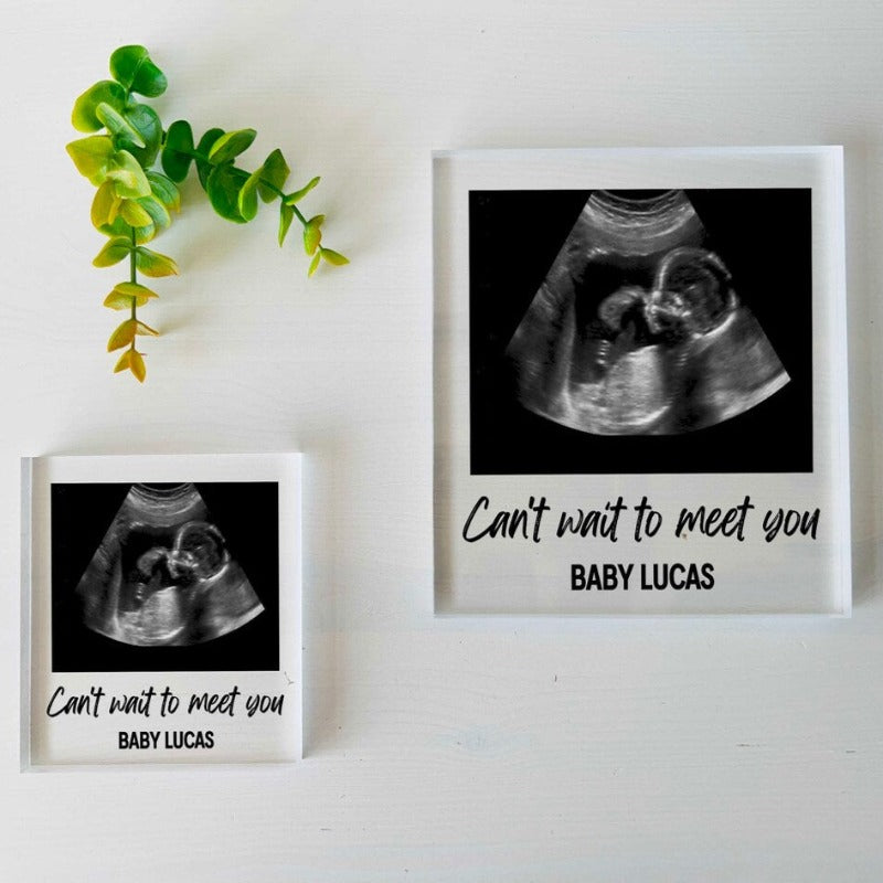 Custom Baby Ultrasound Photo Plaque